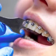 Lifelong Vitality: Tips to Keep Your Teeth Functional at Every Age