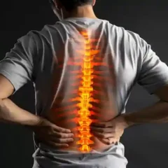 How Spine Procedures Can Improve Quality of Life for People With Severe Spine Conditions