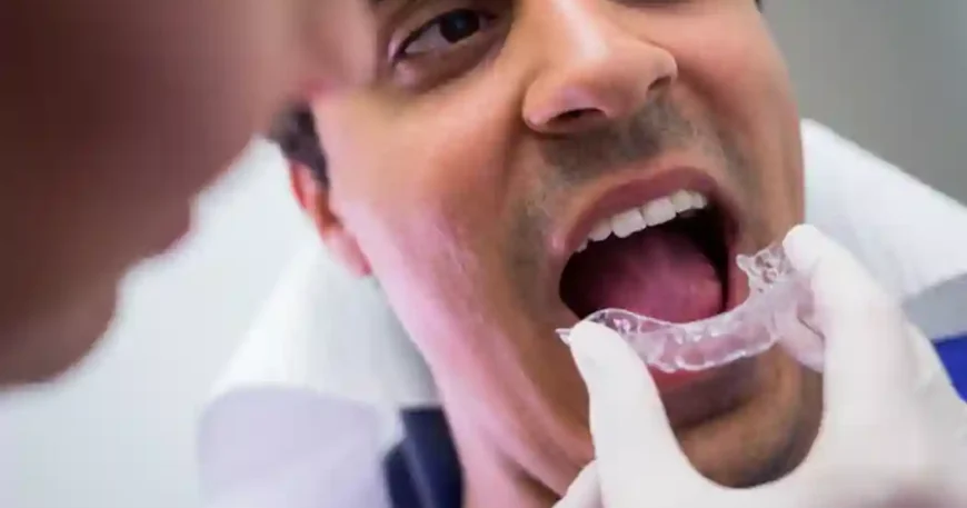 clear invisalign