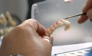 dental implants