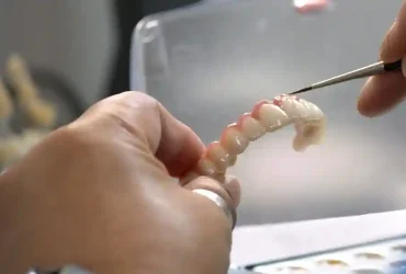 image1 dental implants
