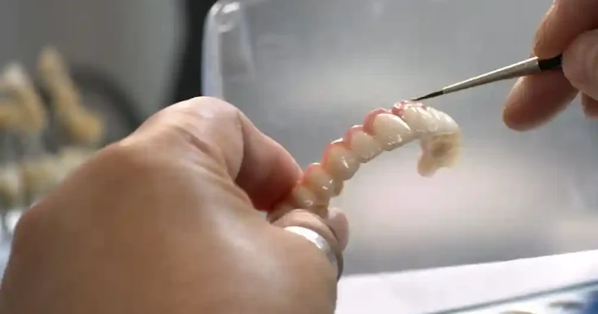 dental implants